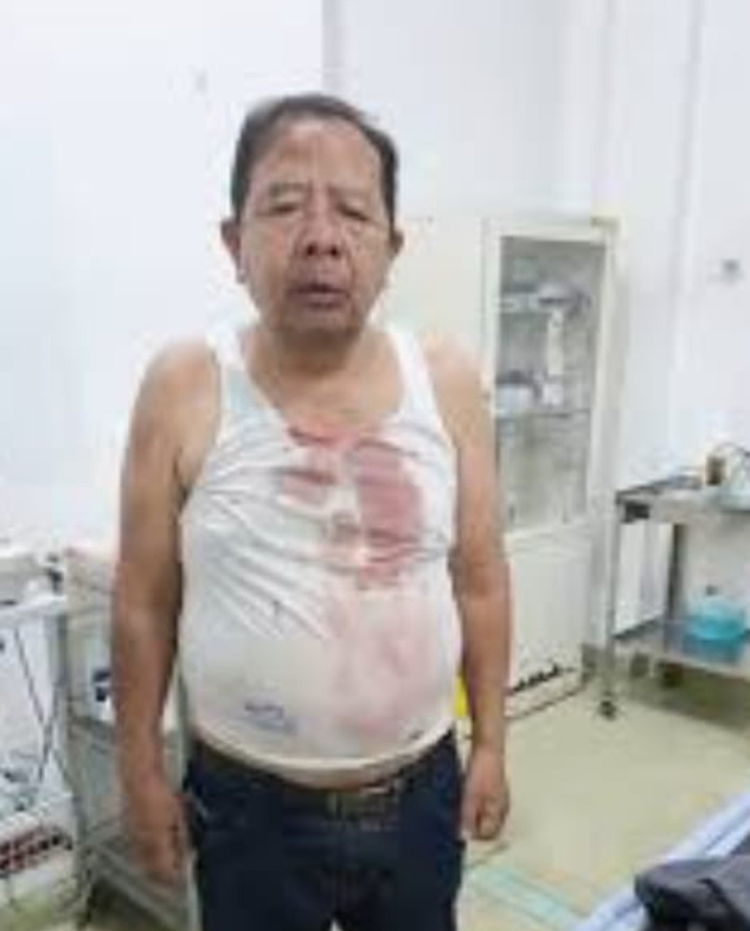 Kapolda Sumut Diminta Tangkap Semua Pelaku Pengeroyokan Pendeta di Sergai 1 Kapolda Sumut
